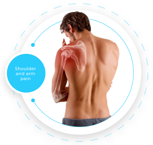 shoulder pain and rotator cuff injury at EAST GOSFORD PHYSIO